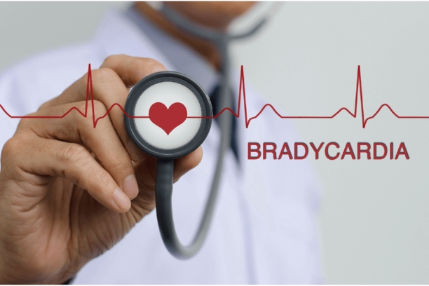 Bradycardia