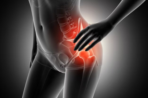 Slipped Disc and Sciatica