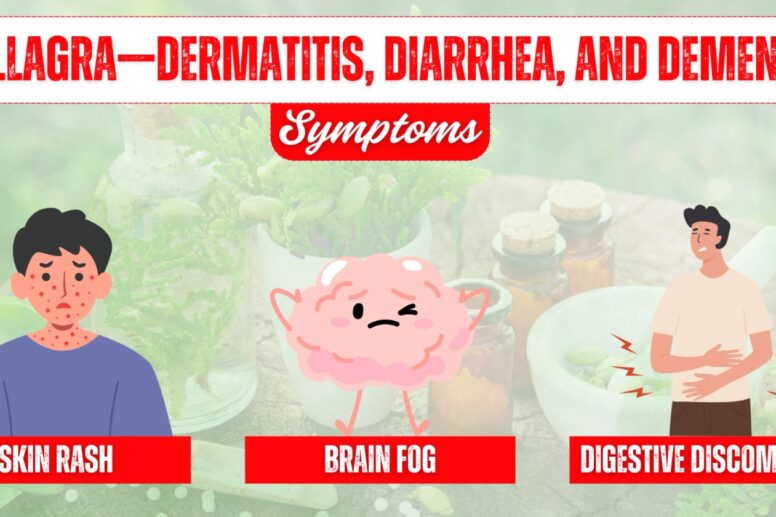 Understanding Pellagra: Symptoms, Causes, Diagnosis, and Management