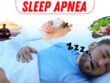 Sleep Apnea: Causes, Prevention, and Natural Treatments for Restful Sleep