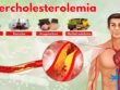 Hypercholesterolemia: Causes, Prevention & Natural Treatments for Heart Health