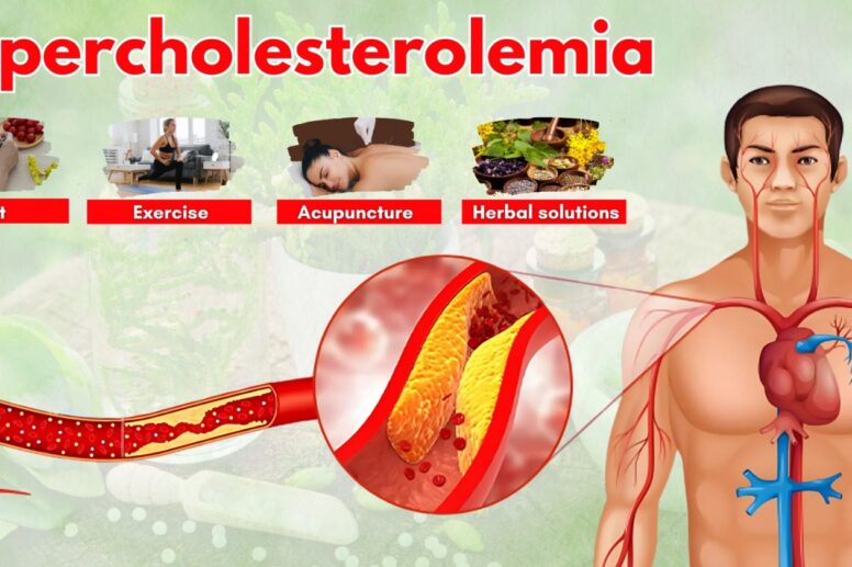 Hypercholesterolemia: Causes, Prevention & Natural Treatments for Heart Health